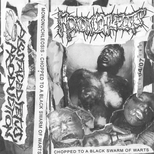 Mononuchleosis : Chopped to a Black Swarm of Warts